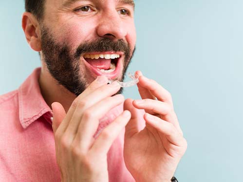 invisalign for adults